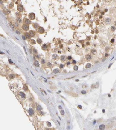 CCDC62 antibody|CCDC62抗体