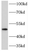 PRKAR1B antibody|PRKAR1B抗体