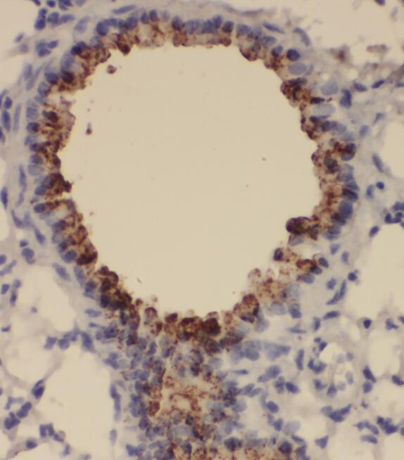 SNRPA1 antibody|SNRPA1抗体