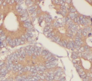 IL37 antibody|IL37抗体 FNab04275