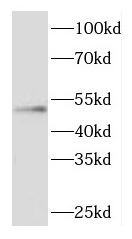CYTH3 antibody|CYTH3抗体