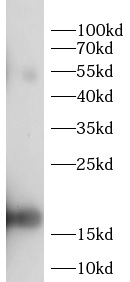 LEP antibody|LEP抗体 FNab10463