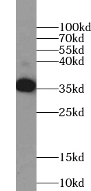 TSPAN11 antibody|TSPAN11抗体