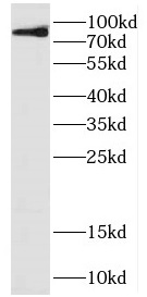 DDHD2 antibody|DDHD2抗体