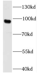 UNC5A antibody|UNC5A抗体 FNab092