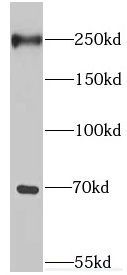 EIF4G3 antibody|EIF4G3抗体