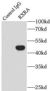RCC1 antibody|RCC1抗体 FNab07209