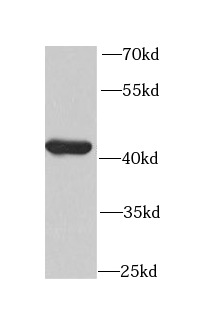 CKMT2 antibody|CKMT2抗体