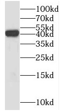 PSAT1 antibody|PSAT1抗体 FNab068