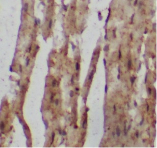 ACTN3 antibody|ACTN3抗体 FNab100