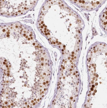SYMPK antibody|SYMPK抗体