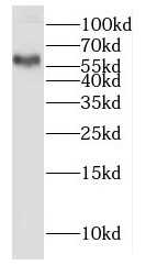 HYAL2 antibody|HYAL2抗体 FNab040