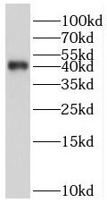 SERPINB9 antibody|SERPINB9抗体