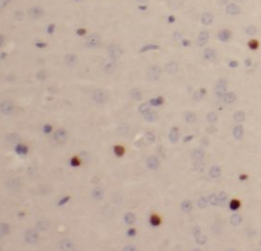 SULT4A1 antibody|SULT4A1抗体 FNa
