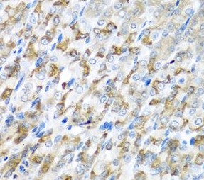 CST1 antibody|CST1抗体