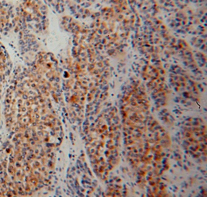 SIGMAR1 antibody|SIGMAR1抗体