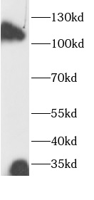 IL4R antibody|IL4R抗体