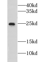 GRPEL1 antibody|GRPEL1抗体