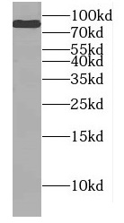 DNAI1 antibody|DNAI1抗体