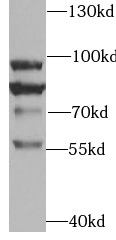 TRPV4 antibody|TRPV4抗体