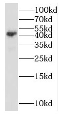 PPM1K antibody|PPM1K抗体