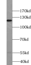 APBA2 antibody|APBA2抗体