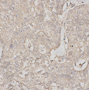 TNC antibody|TNC抗体