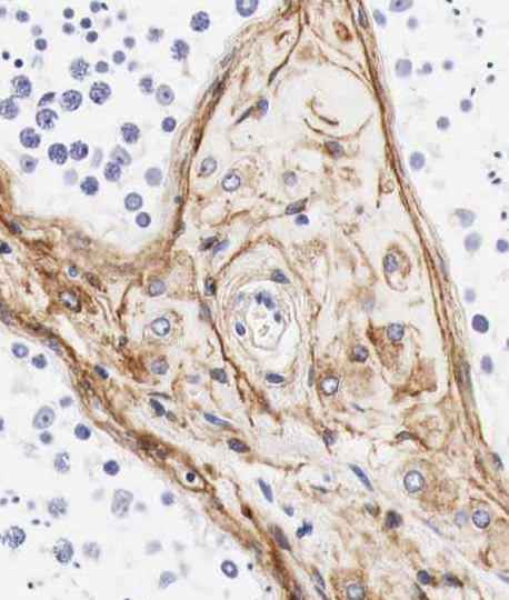 RAB3GAP1 antibody|RAB3GAP1抗体