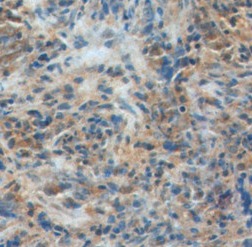 IL33 antibody|IL33抗体 FNab04272