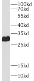 PRDX4 antibody|PRDX4抗体 FNab067