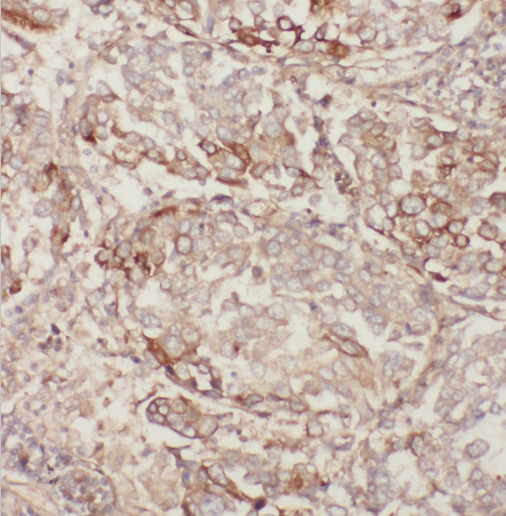 MGRN1 antibody|MGRN1抗体