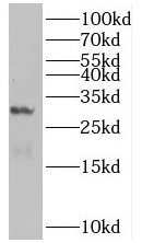 BHLHA15 antibody|BHLHA15抗体