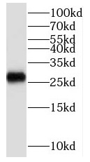 SCO2 antibody|SCO2抗体