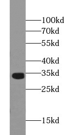 OTX2 antibody|OTX2抗体 FNab06044