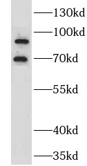 GRK3 antibody|GRK3抗体