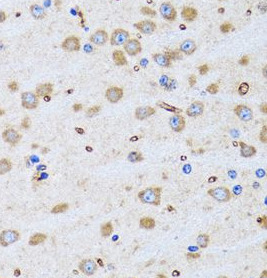PTRH2 antibody|PTRH2抗体