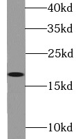 THRSP antibody|THRSP抗体