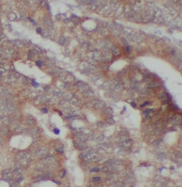 FGA antibody|FGA抗体 FNab10059