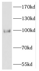 DACH1 antibody|DACH1抗体