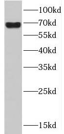 HDAC10 antibody|HDAC10抗体 FNab0
