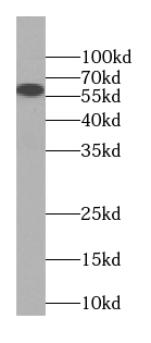 ACCS antibody|ACCS抗体