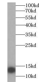 GUCA2B antibody|GUCA2B抗体