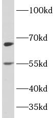 PLAGL2 antibody|PLAGL2抗体