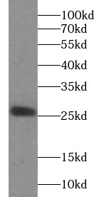 IL1RN antibody|IL1RN抗体