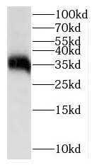 IGFBP1 antibody|IGFBP1抗体