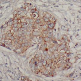 AGR2 antibody|AGR2抗体 FNab00219