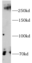 CSPG4 antibody|CSPG4抗体 FNab105