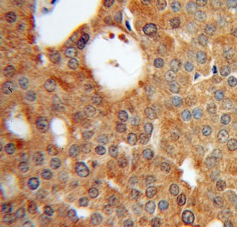 EML2 antibody|EML2抗体