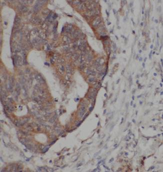 PPIC antibody|PPIC抗体 FNab09981