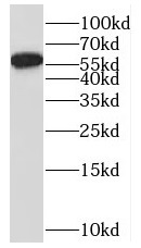 MUTYH antibody|MUTYH抗体 FNab054